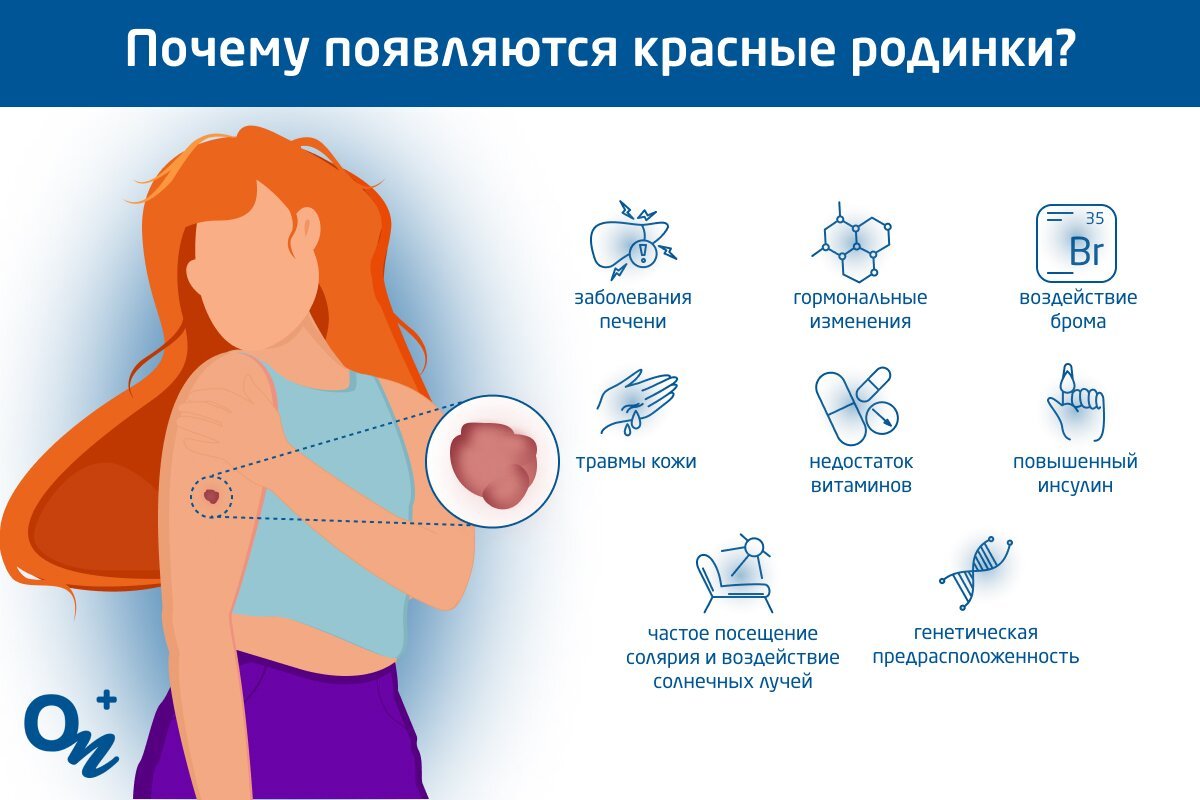 Родинки на теле и лице: о чём говорят